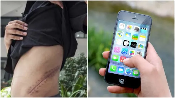 Adolescente que vendeu um rim por um iPhone agora está acamado para o resto da vida