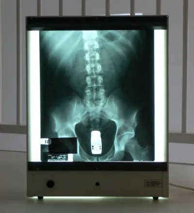 Како је рендгенски снимак кундака Рајана Дунна постао уметничко дело